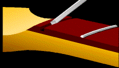Cleaning Debris And Glue With A Chisel